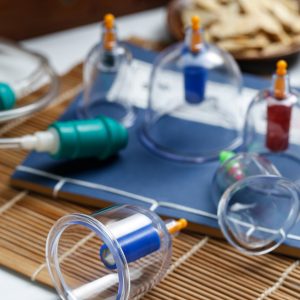 Cupping therapy of traditional Chinese medicine